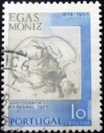 Selo postal de Portugal de 1974 Cerebral angiograph